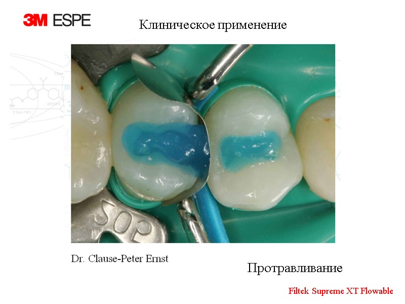 Протравливание  Клиническое применение